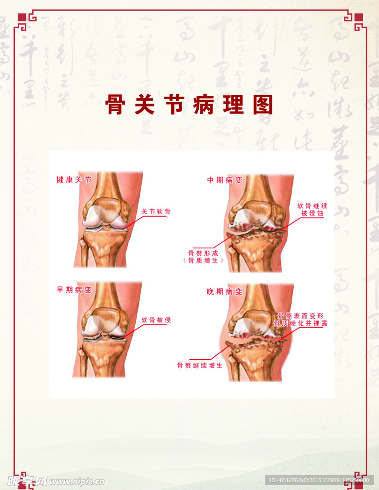 骨关节病理图