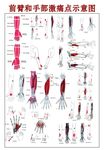 前臂和手部激痛点示意图