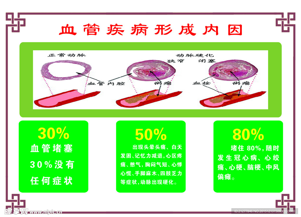 血管疾病形成内因