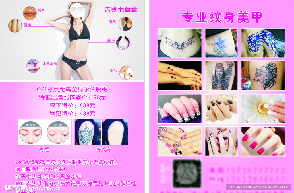 冰点脱毛