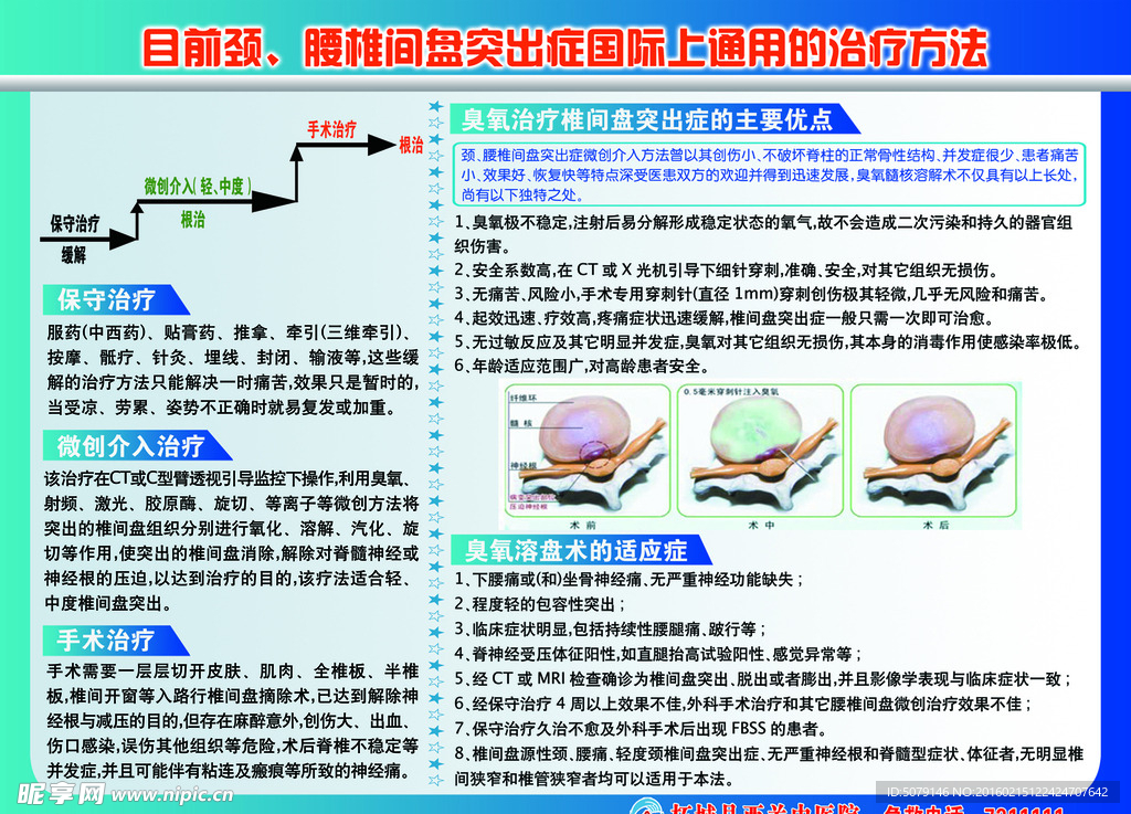 腰椎间盘突出