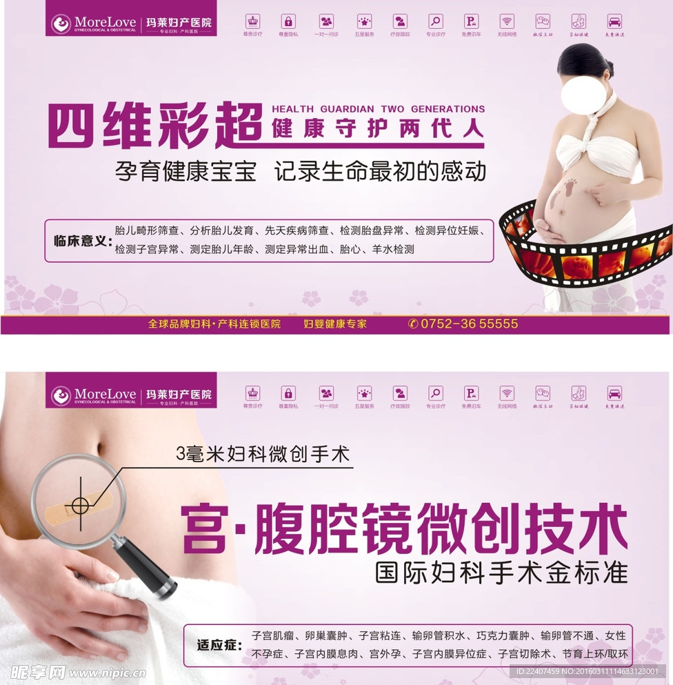 宫腹腔微创