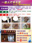 一德火疗养生堂