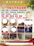 一德火疗养生堂