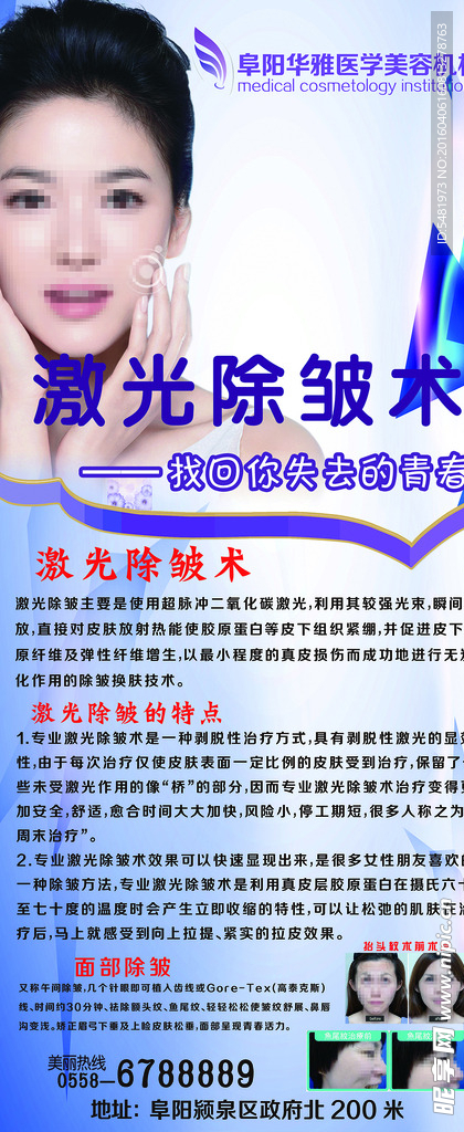 激光除皱