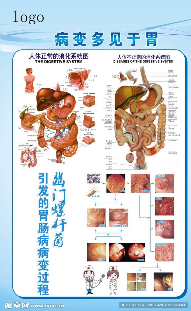 胃肠病变展板