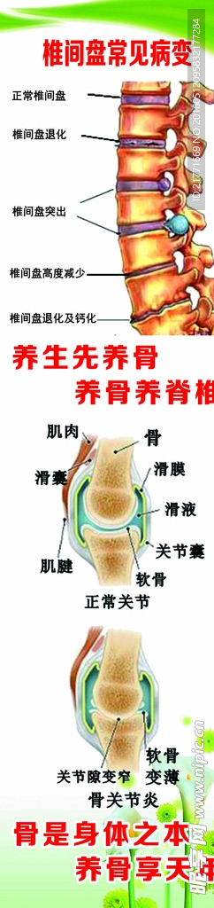 椎间盘突出常见病变