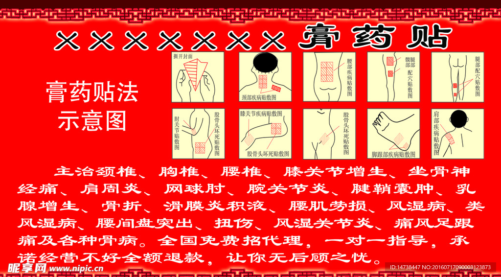 膏药贴示意图