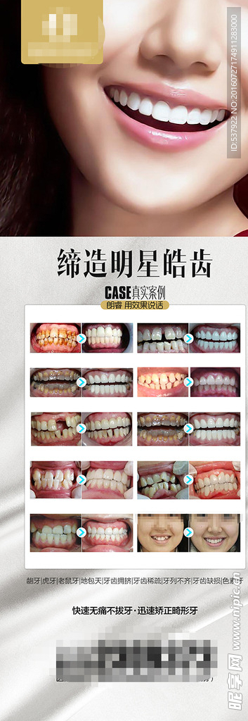 整形项目X展架