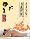 火疗