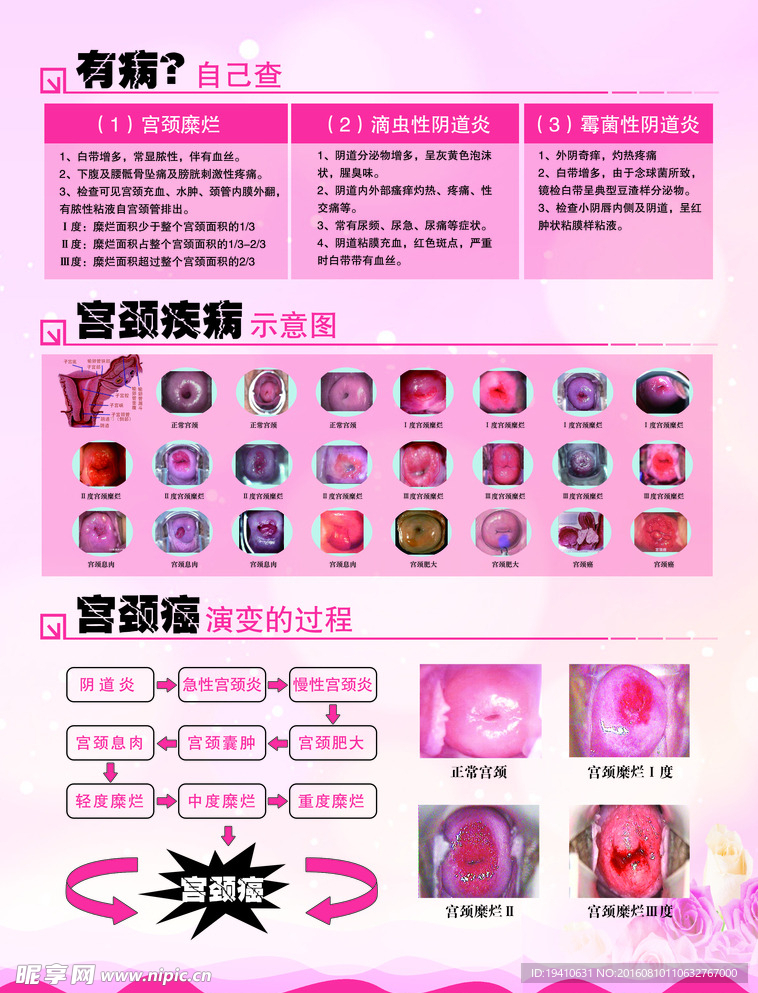妇科宣传单
