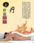 火疗
