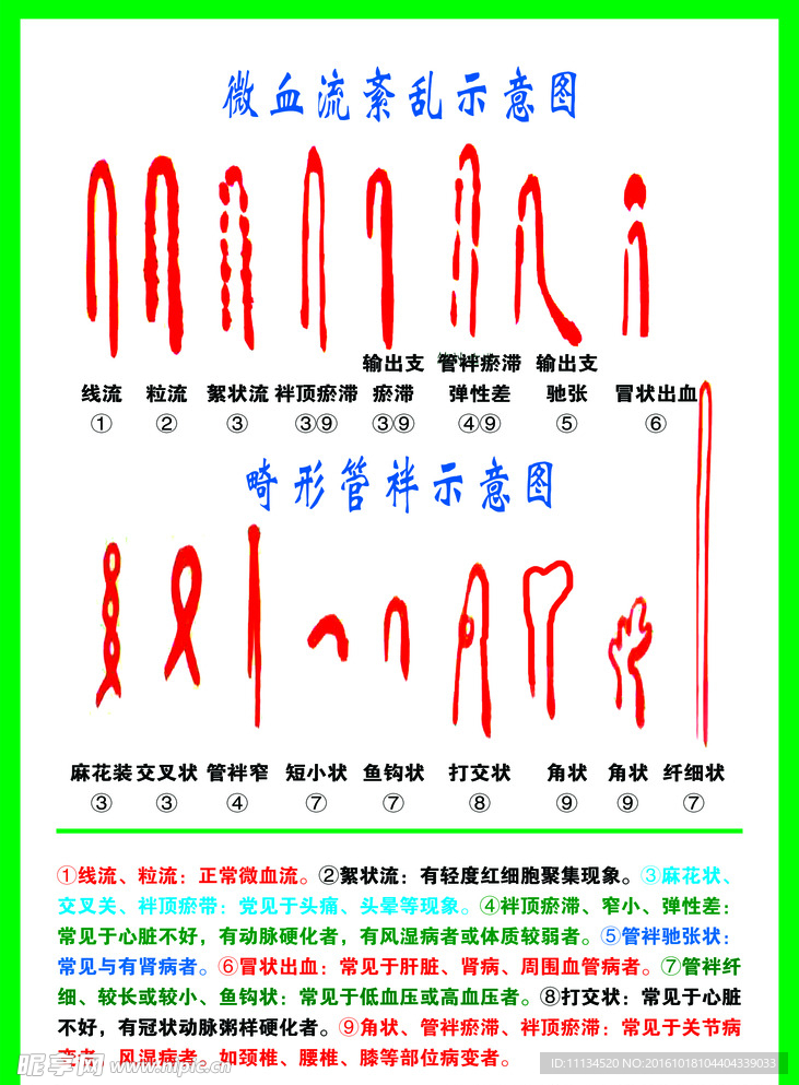 微血流紊乱示意图