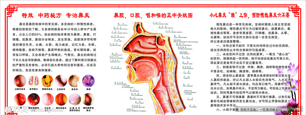 鼻炎展版