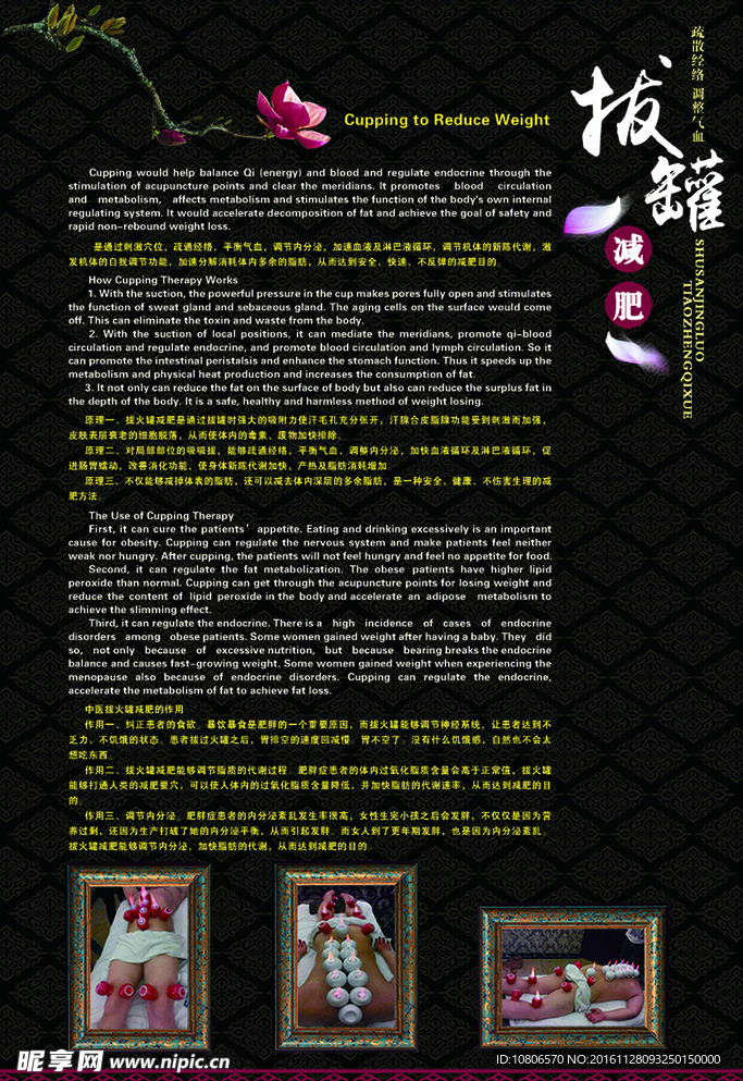拔罐减肥海报