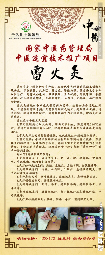 雷火灸