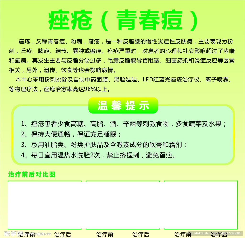 痤疮
