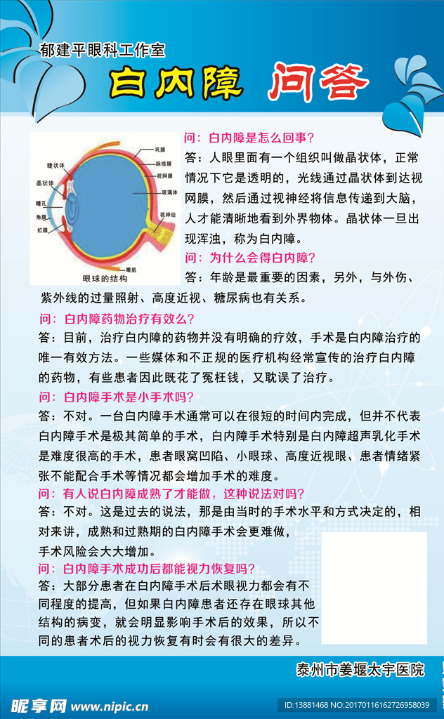 白内障问答