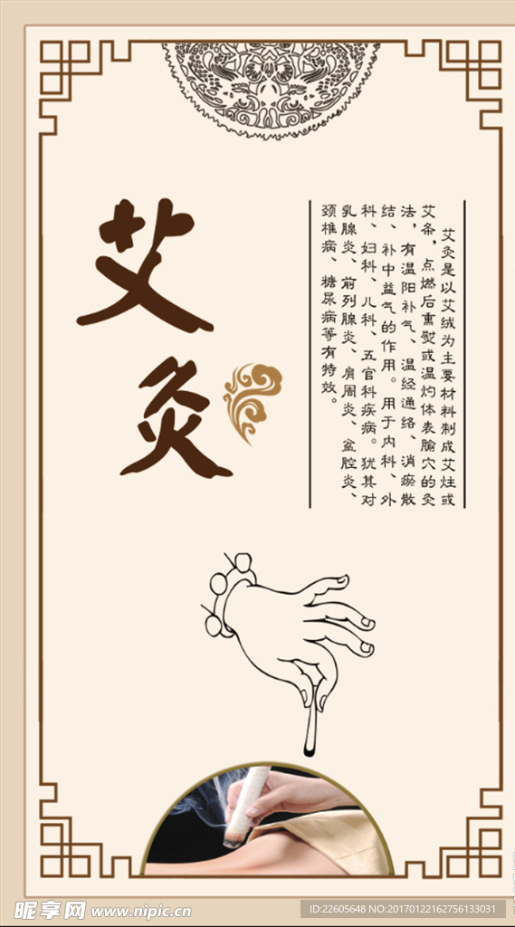 艾灸