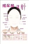 玻尿酸 注射