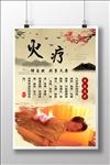 火疗