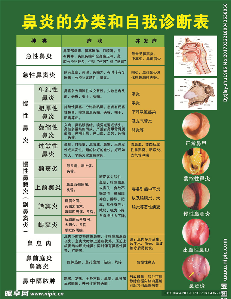 鼻炎的分类和自我诊断