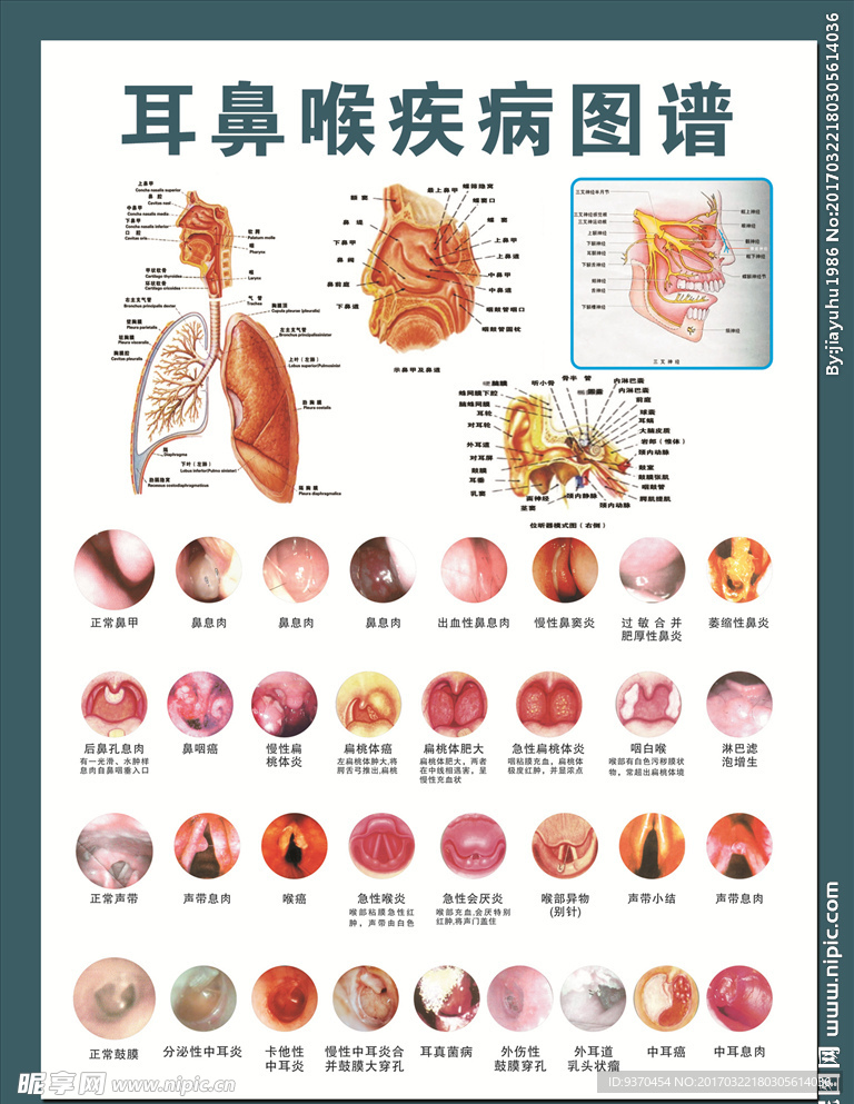 耳鼻喉疾病图谱