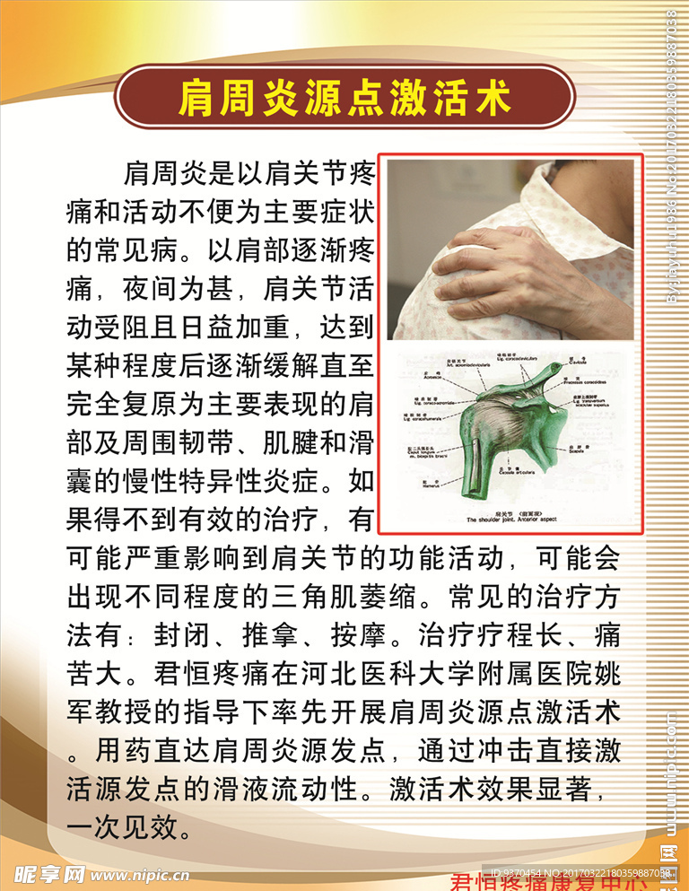 肩周炎