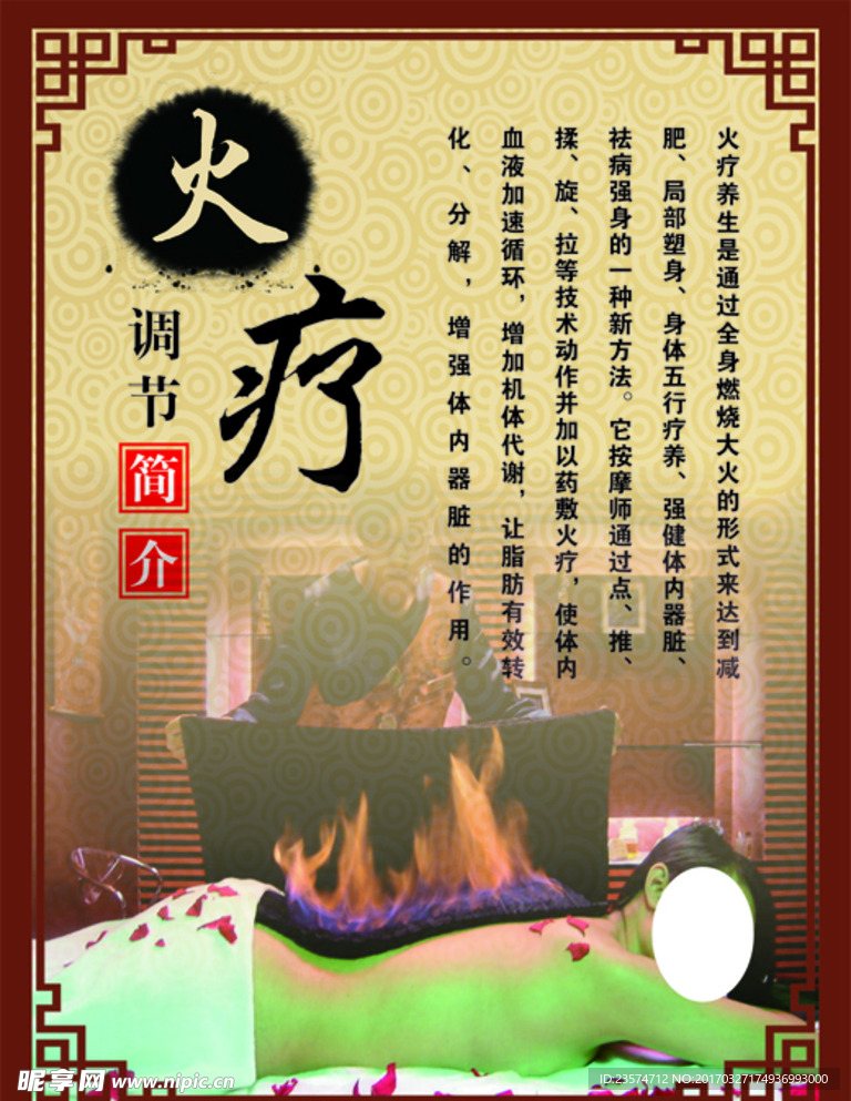 养生文化之火疗