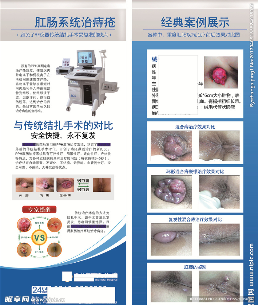 肛肠竖展牌 多图