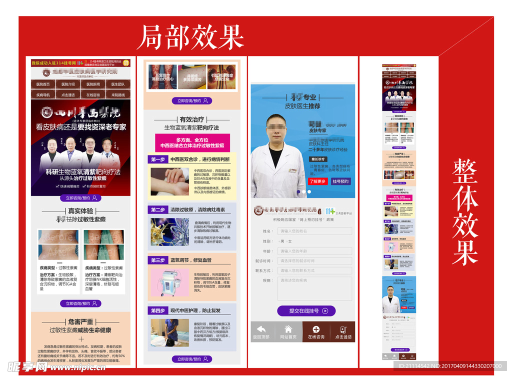 过敏性紫