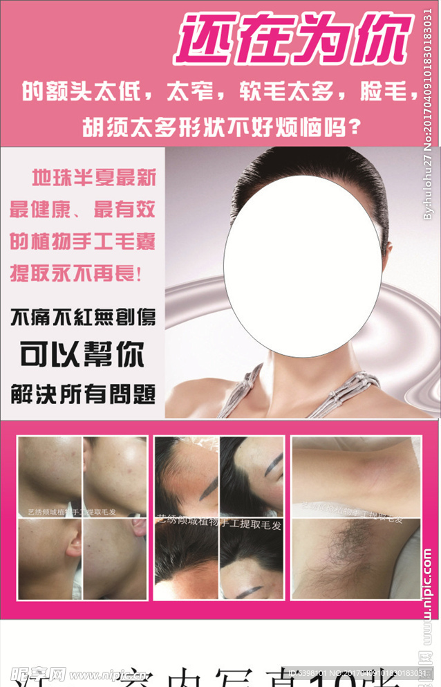 脱毛