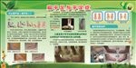 照片展板