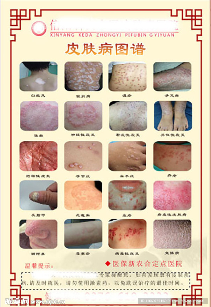 皮肤病图谱
