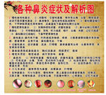 鼻炎