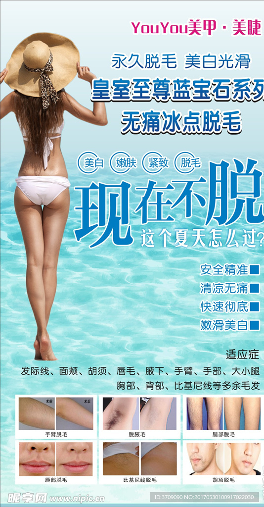 冰点脱毛