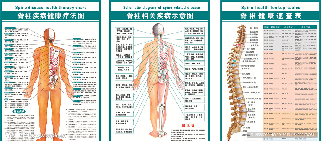 脊柱疾病相关示意图