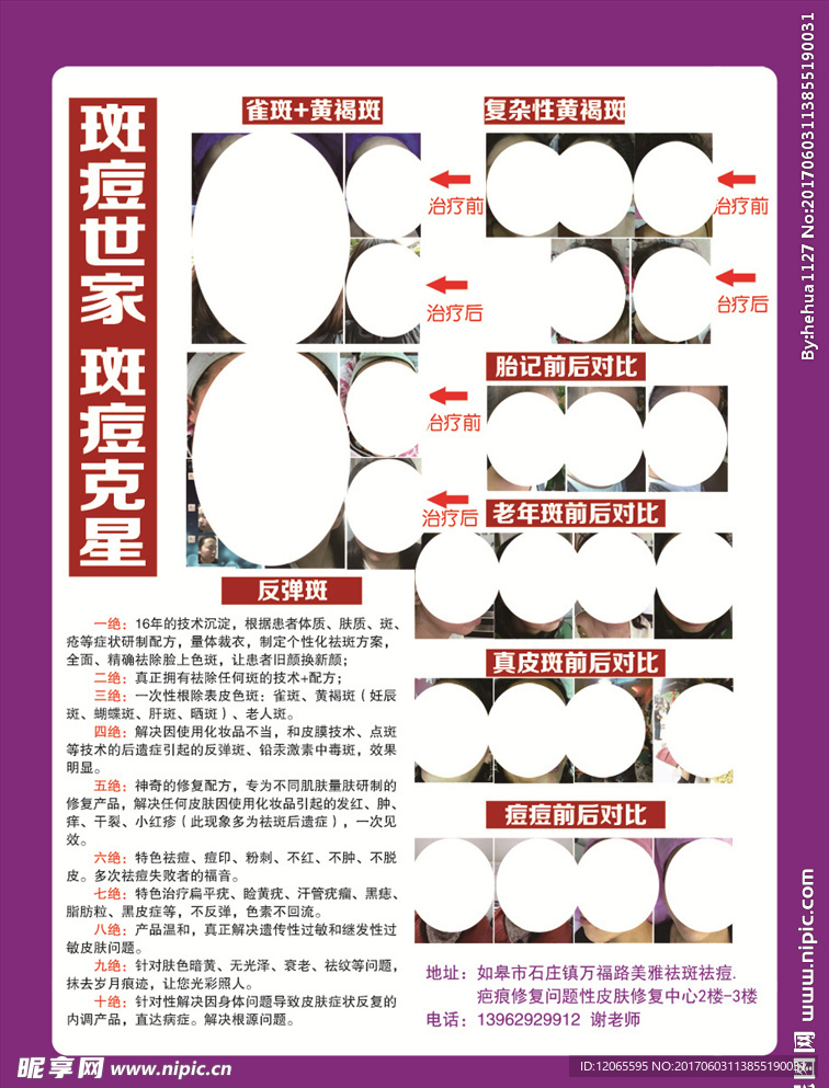 祛斑彩页