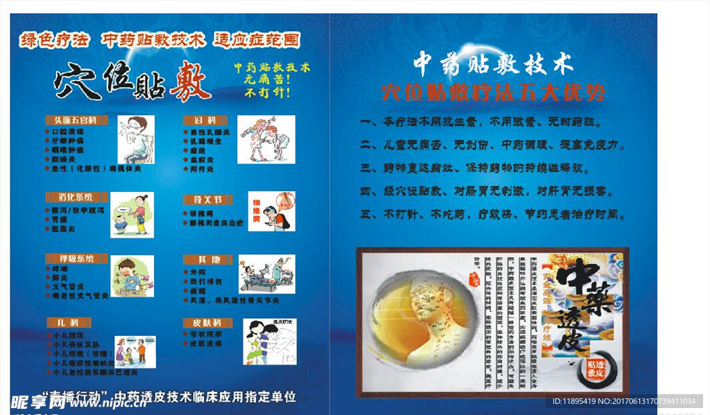 亚宝中草药贴敷