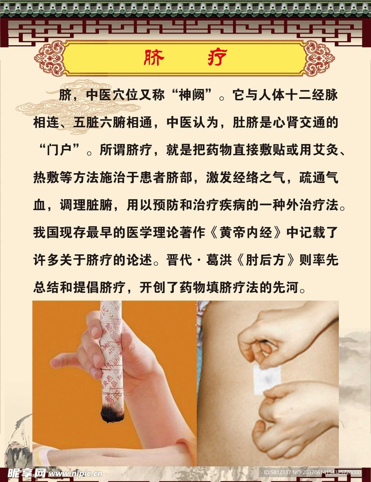 脐疗