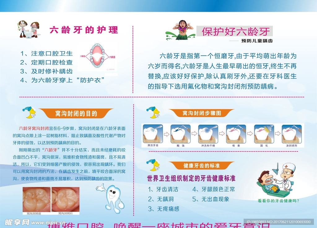 六龄牙  窝沟封闭 cdr 矢