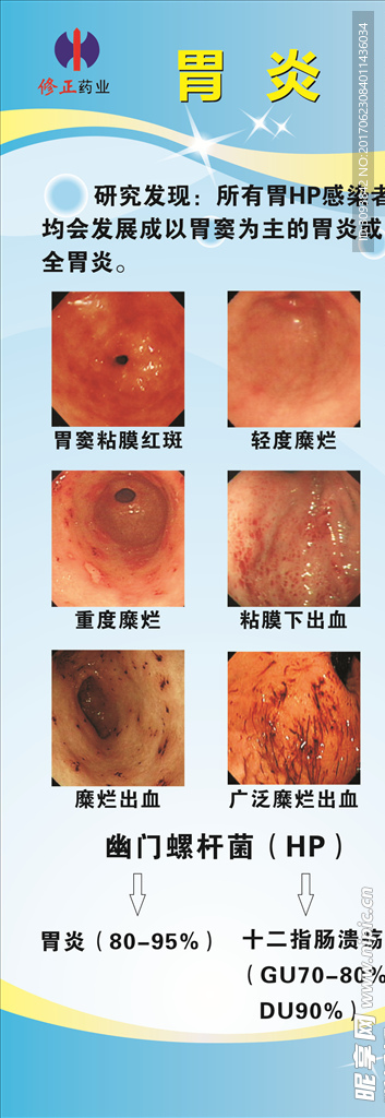 修正 胃炎海报 展架 易拉宝