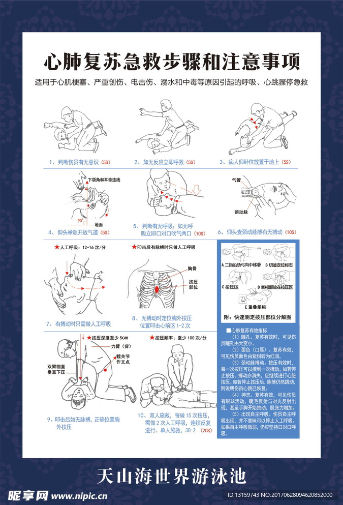 心肺复苏