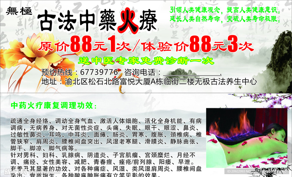 火疗优惠券