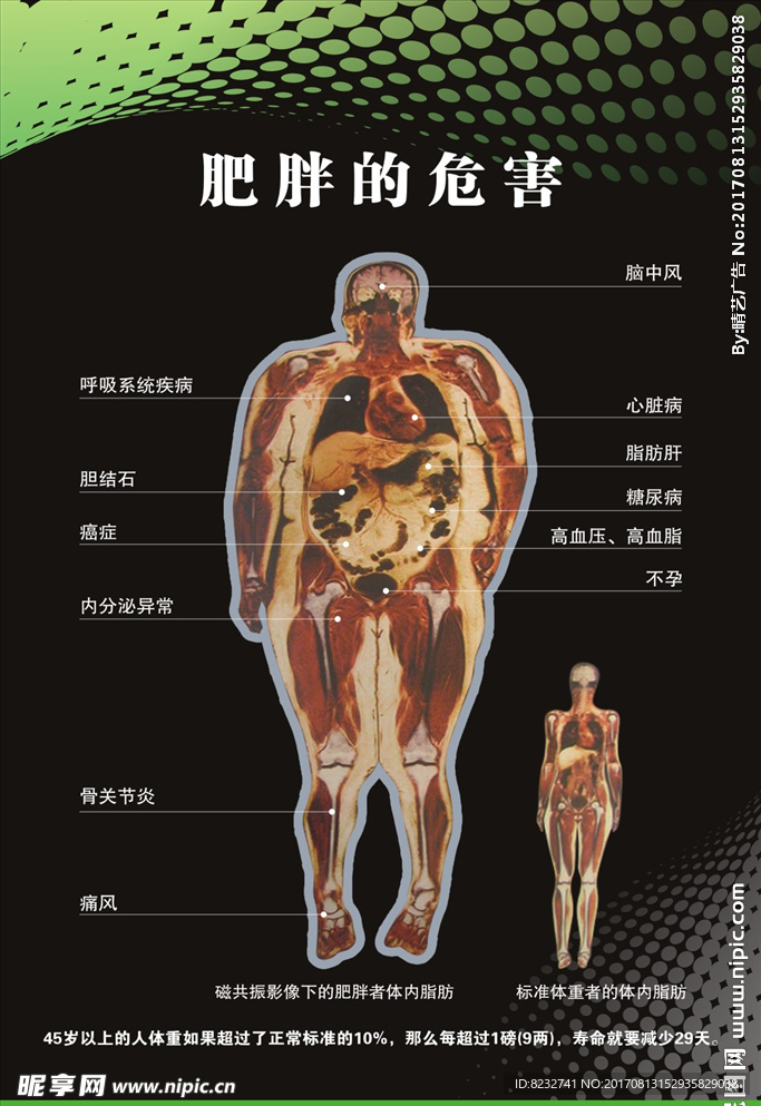 肥胖的危害 肥胖素材 减肥