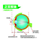 眼球 分解 简析