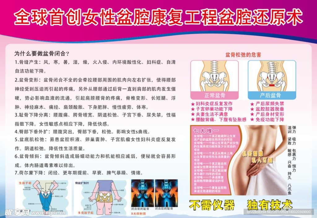 女性盆腔康复工程盆腔还原术