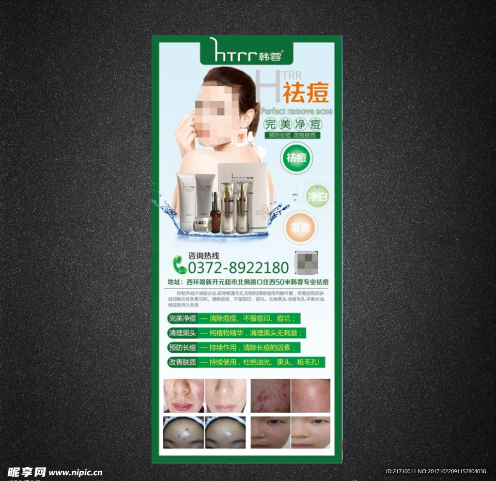 美容祛痘展架