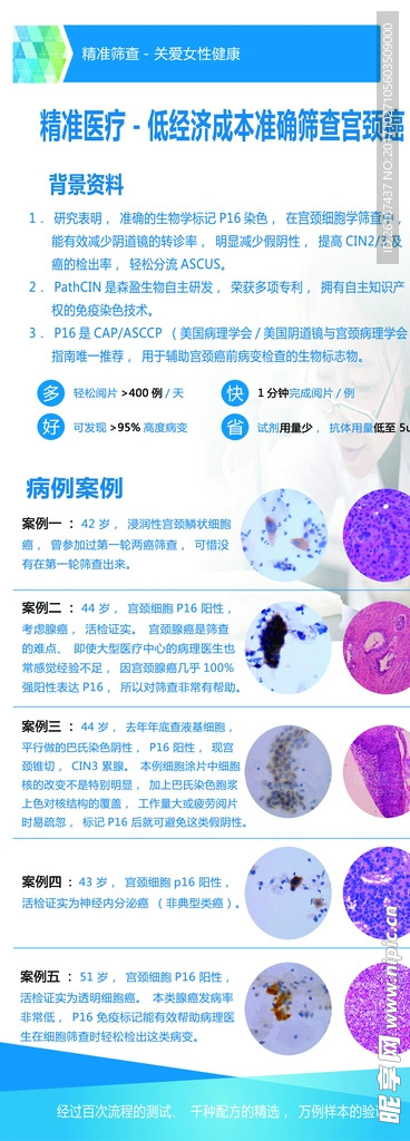 展架设计