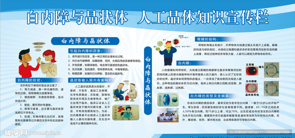 白内障与晶状体